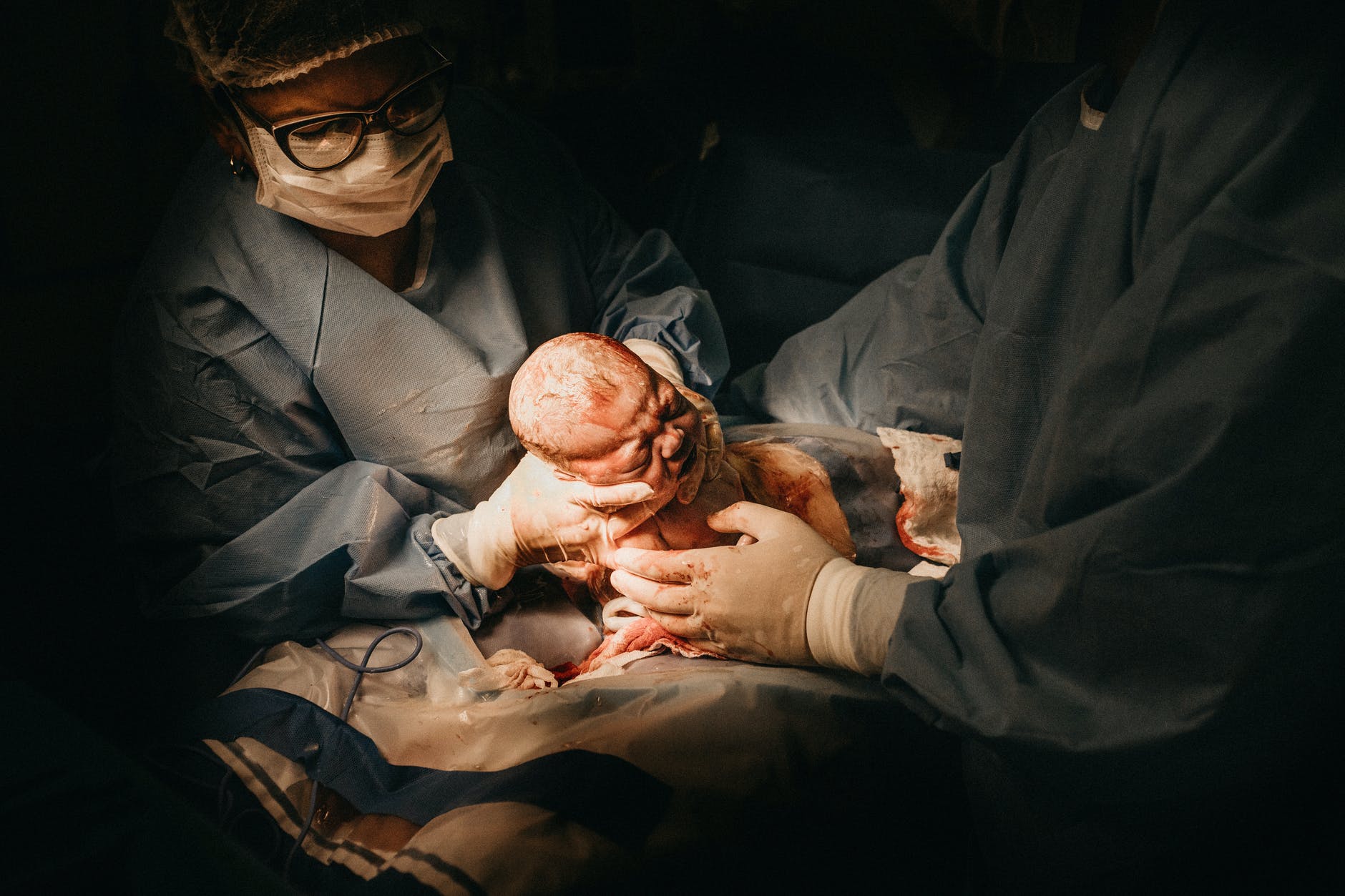 woman giving birth to baby via c section